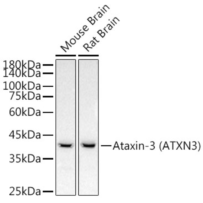 Ataxin-3 (ATXN3) Rabbit Monoclonal Antibody