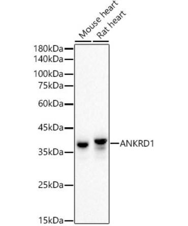 ANKRD1 Rabbit Monoclonal Antibody