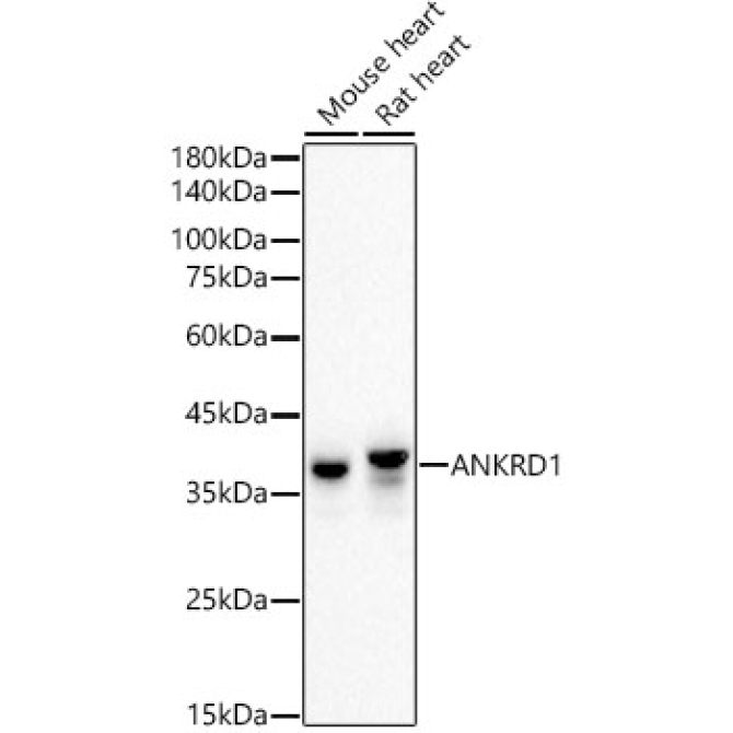 ANKRD1 Rabbit Monoclonal Antibody