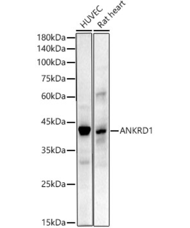ANKRD1 Rabbit Monoclonal Antibody