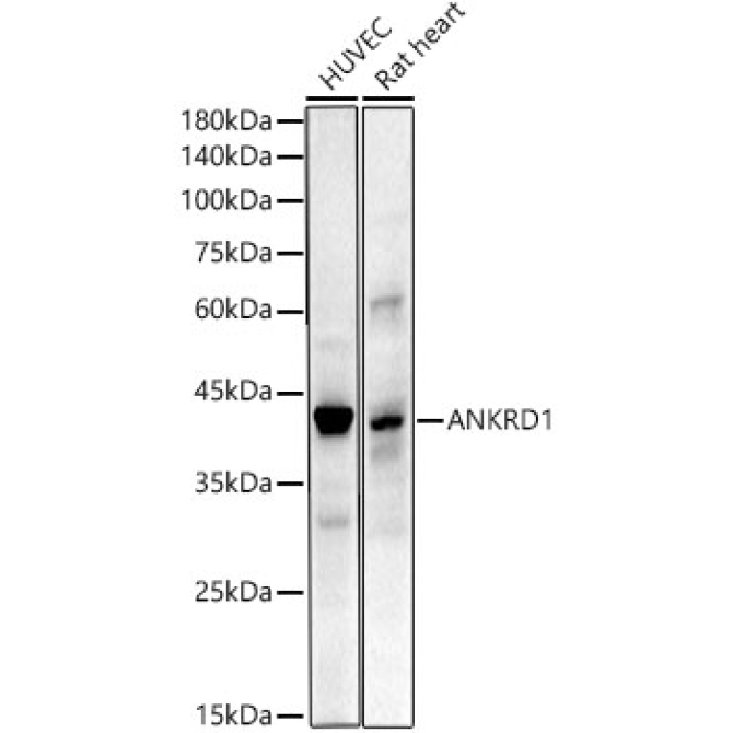 ANKRD1 Rabbit Monoclonal Antibody