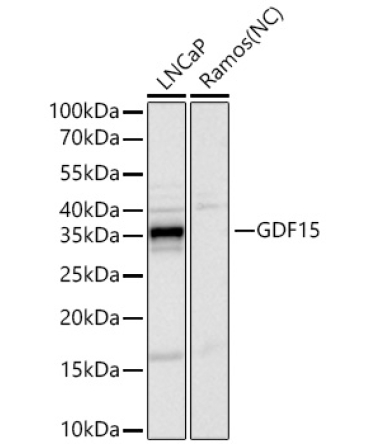GDF15 Rabbit Monoclonal Antibody