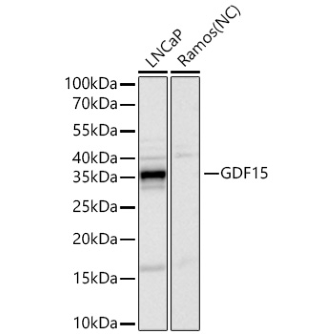 GDF15 Rabbit Monoclonal Antibody