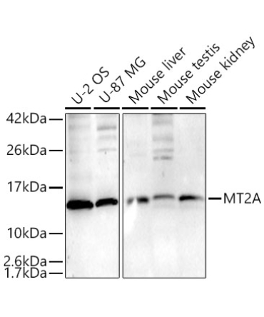 MT2A Rabbit Polyclonal Antibody [KD Validated]