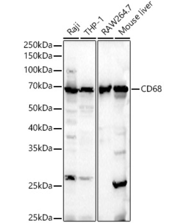 CD68 Rabbit Polyclonal Antibody [KO Validated]