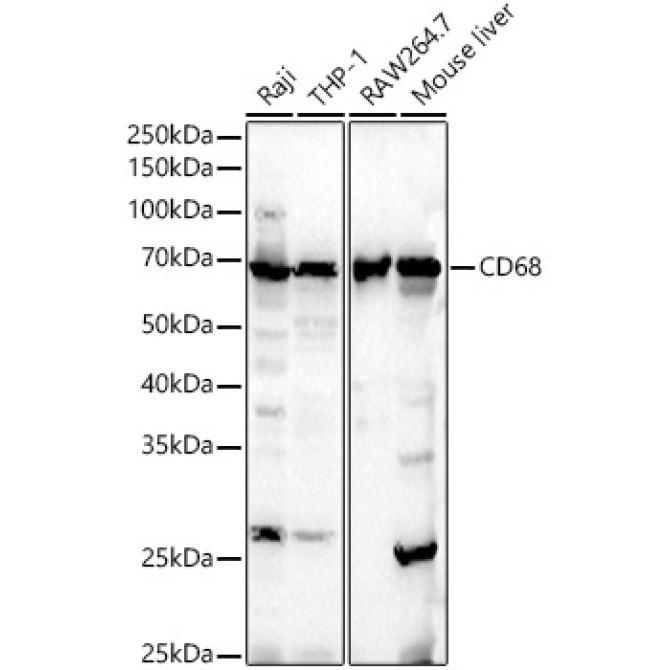 CD68 Rabbit Polyclonal Antibody [KO Validated]