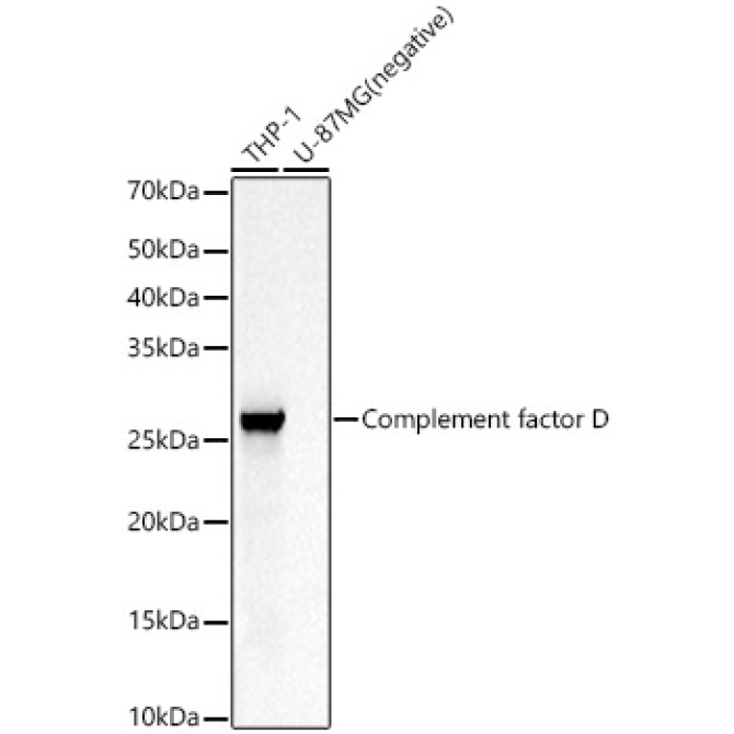 Complement factor D Rabbit Polyclonal Antibody