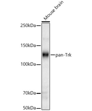 pan-Trk Rabbit Polyclonal Antibody