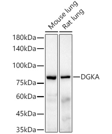 DGKA Rabbit Monoclonal Antibody