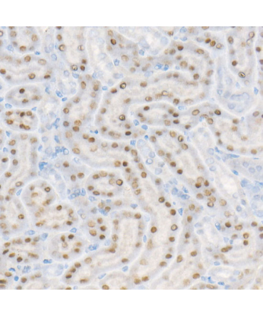 HNF1Alpha Rabbit Monoclonal Antibody