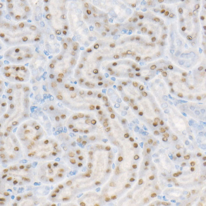 HNF1Alpha Rabbit Monoclonal Antibody