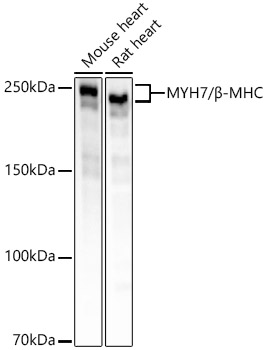 MYH7/Beta-MHC Rabbit Monoclonal Antibody