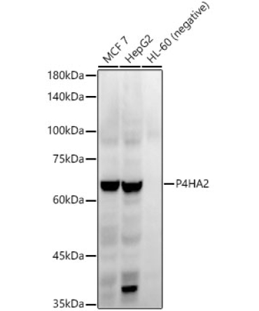 P4HA2 Rabbit Monoclonal Antibody