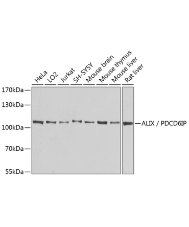 ALIX / PDCD6IP Rabbit Polyclonal Antibody