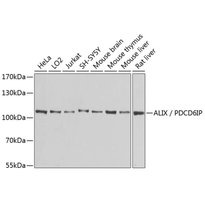 ALIX / PDCD6IP Rabbit Polyclonal Antibody