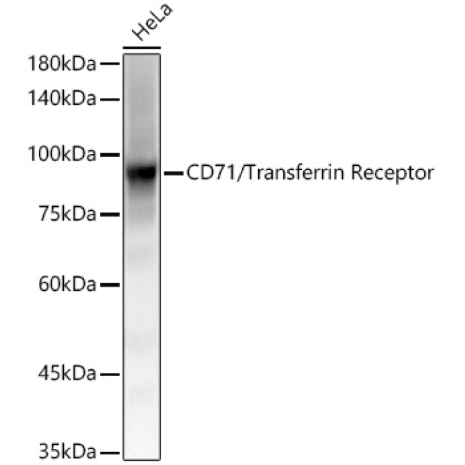 CD71/Transferrin Receptor Rabbit Monoclonal Antibody