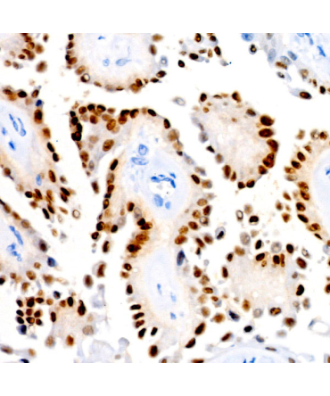 PAX8 Rabbit Monoclonal Antibody