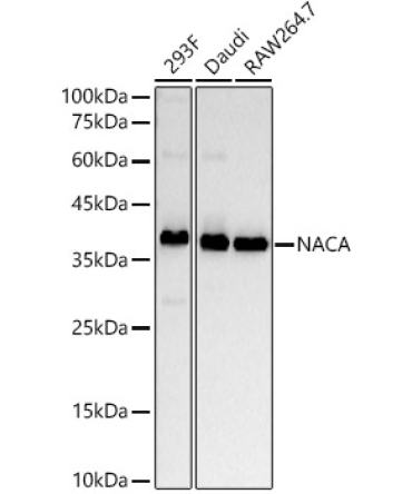 NACA Rabbit Monoclonal Antibody