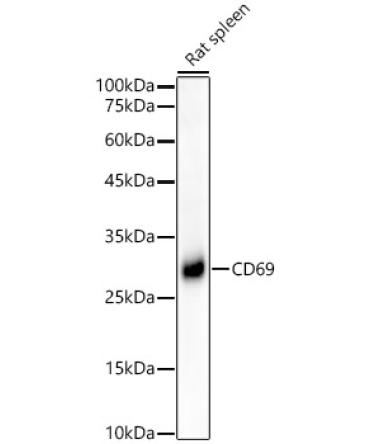 CD69 Rabbit Monoclonal Antibody