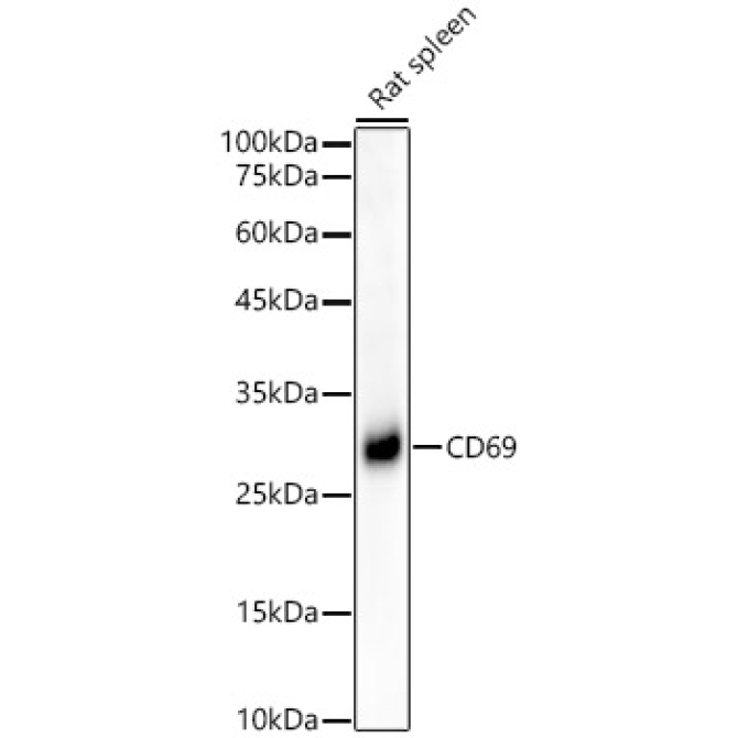 CD69 Rabbit Monoclonal Antibody