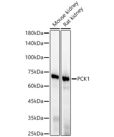 PCK1 Rabbit Monoclonal Antibody