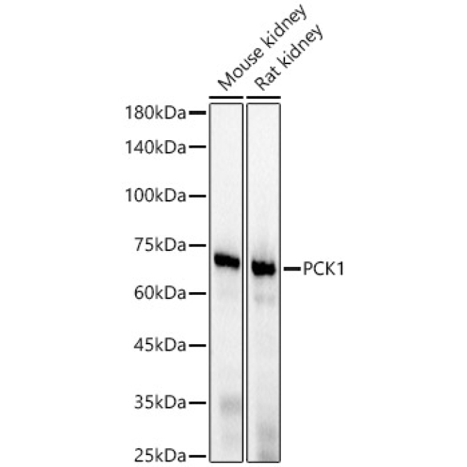 PCK1 Rabbit Monoclonal Antibody