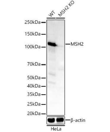 MSH2 Rabbit Monoclonal Antibody [KO Validated]