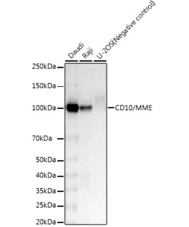 CD10/MME Rabbit Monoclonal Antibody