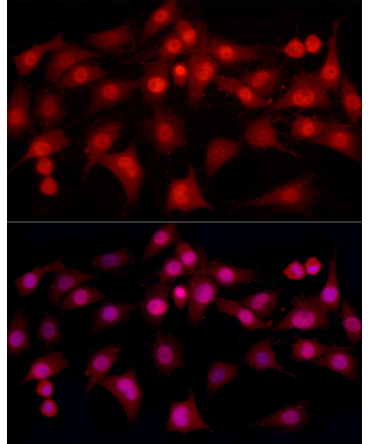 ESRAlpha Rabbit Monoclonal Antibody