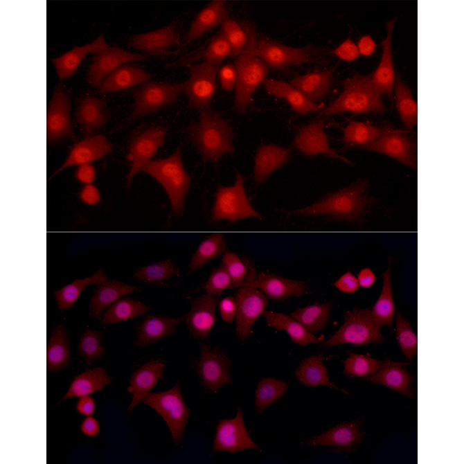 ESRAlpha Rabbit Monoclonal Antibody