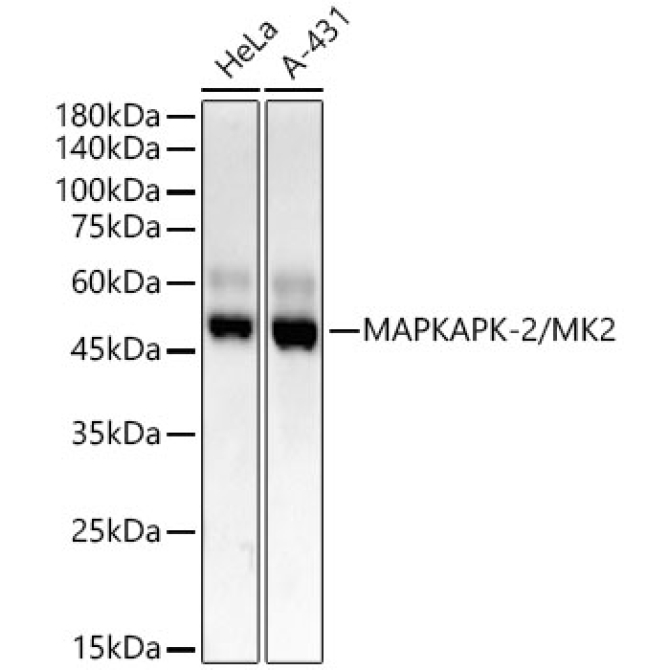 MAPKAPK-2/MK2 Rabbit Monoclonal Antibody