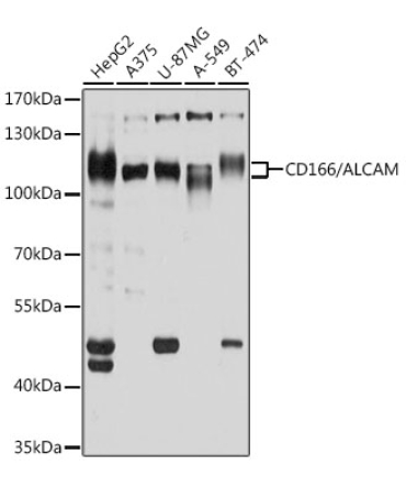 CD166/ALCAM Rabbit Polyclonal Antibody