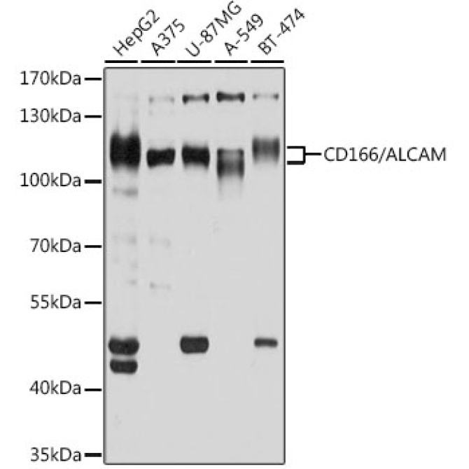 CD166/ALCAM Rabbit Polyclonal Antibody
