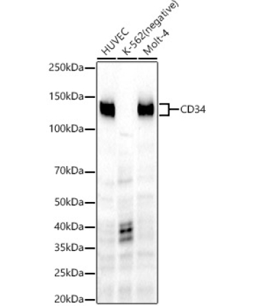 CD34 Rabbit Monoclonal Antibody