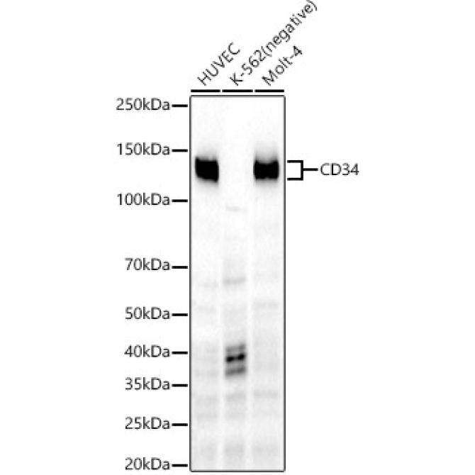 CD34 Rabbit Monoclonal Antibody