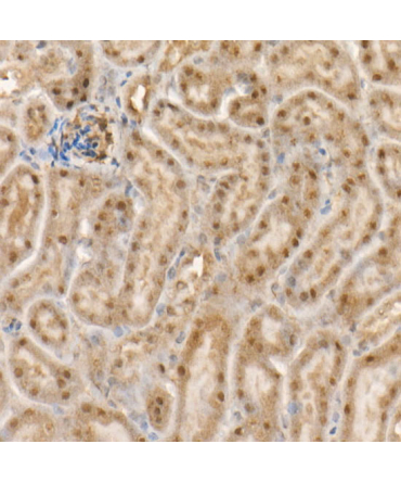 c-Abl Rabbit Monoclonal Antibody