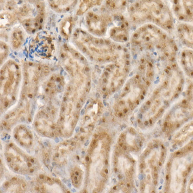 c-Abl Rabbit Monoclonal Antibody