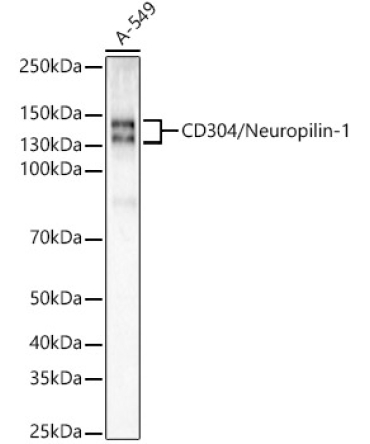 Neuropilin-1 (NRP1) Rabbit Monoclonal Antibody