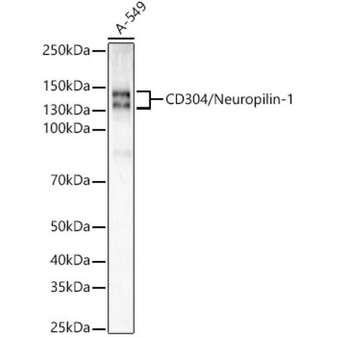 Neuropilin-1 (NRP1) Rabbit Monoclonal Antibody
