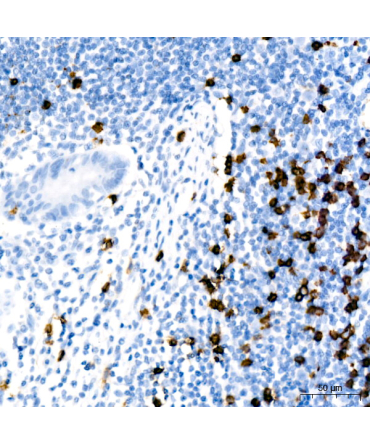 CD8A Rabbit Monoclonal Antibody