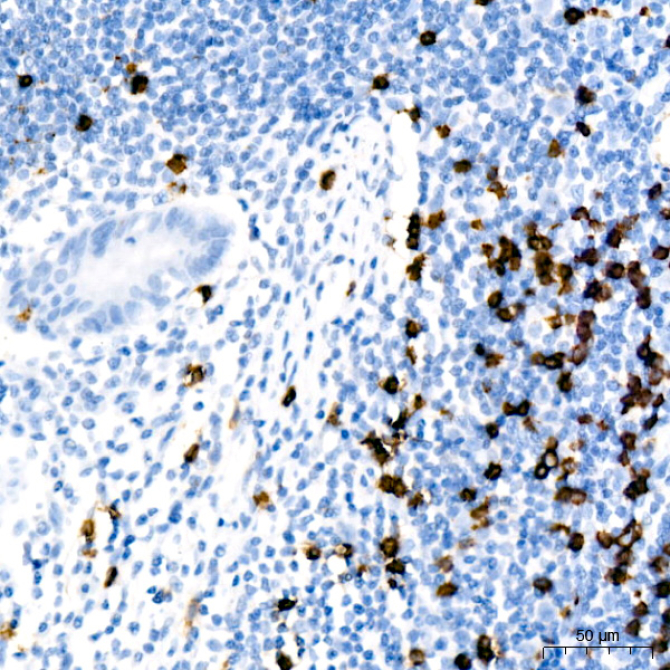 CD8A Rabbit Monoclonal Antibody