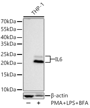 IL6 Rabbit Monoclonal Antibody