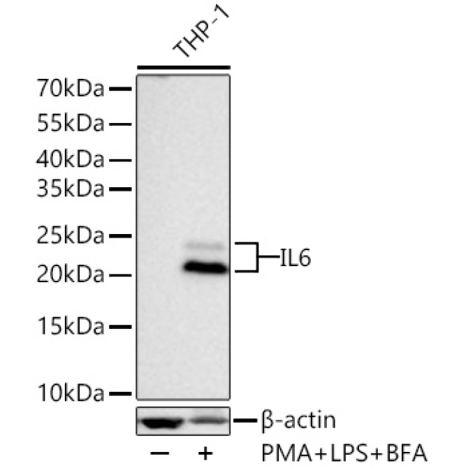 IL6 Rabbit Monoclonal Antibody