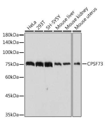 CPSF73 Rabbit Monoclonal Antibody