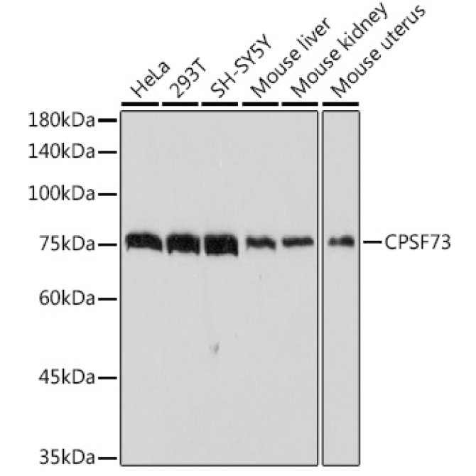 CPSF73 Rabbit Monoclonal Antibody