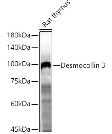 Desmocollin 3 Rabbit Polyclonal Antibody