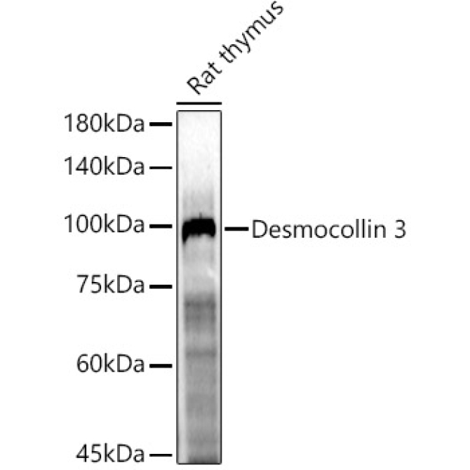 Desmocollin 3 Rabbit Polyclonal Antibody