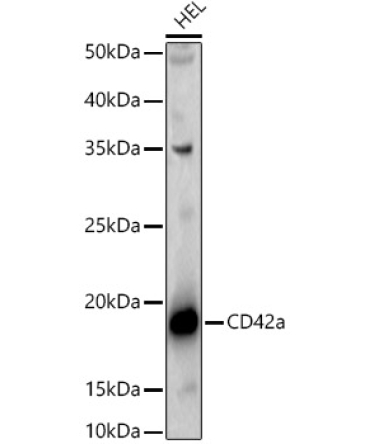 CD42a Rabbit Polyclonal Antibody