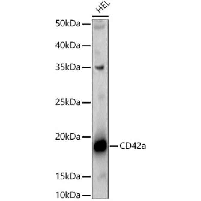 CD42a Rabbit Polyclonal Antibody