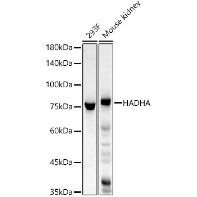 HADHA Rabbit Polyclonal Antibody